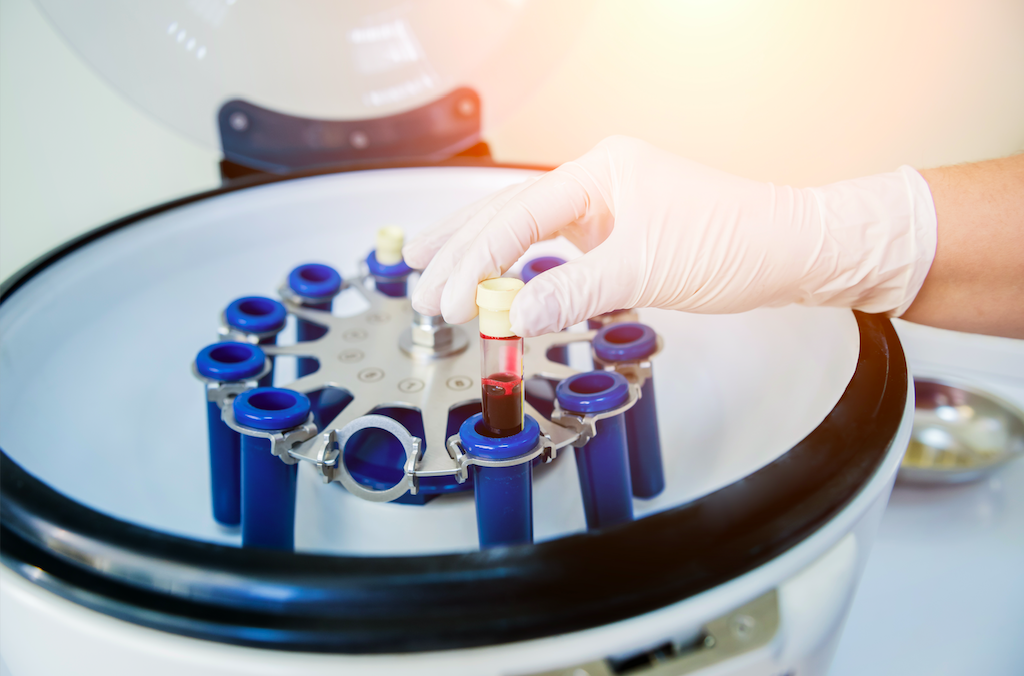 What Is PRP Treatment?