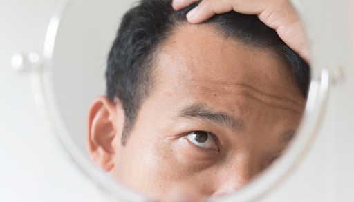 Istanbul Offers Great Alternatives For Hair Transplantation