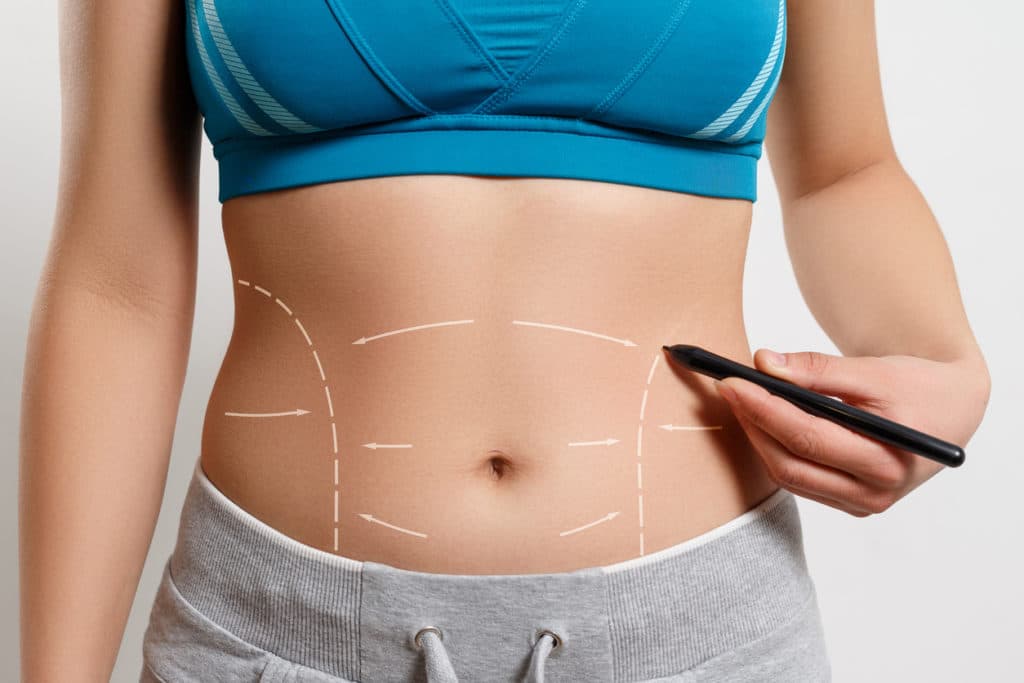 Tummy Tuck Surgery in Istanbul