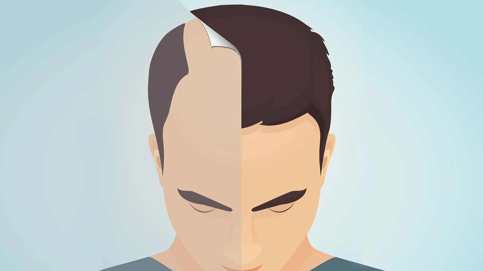 Best City for Hair Transplants: Istanbul