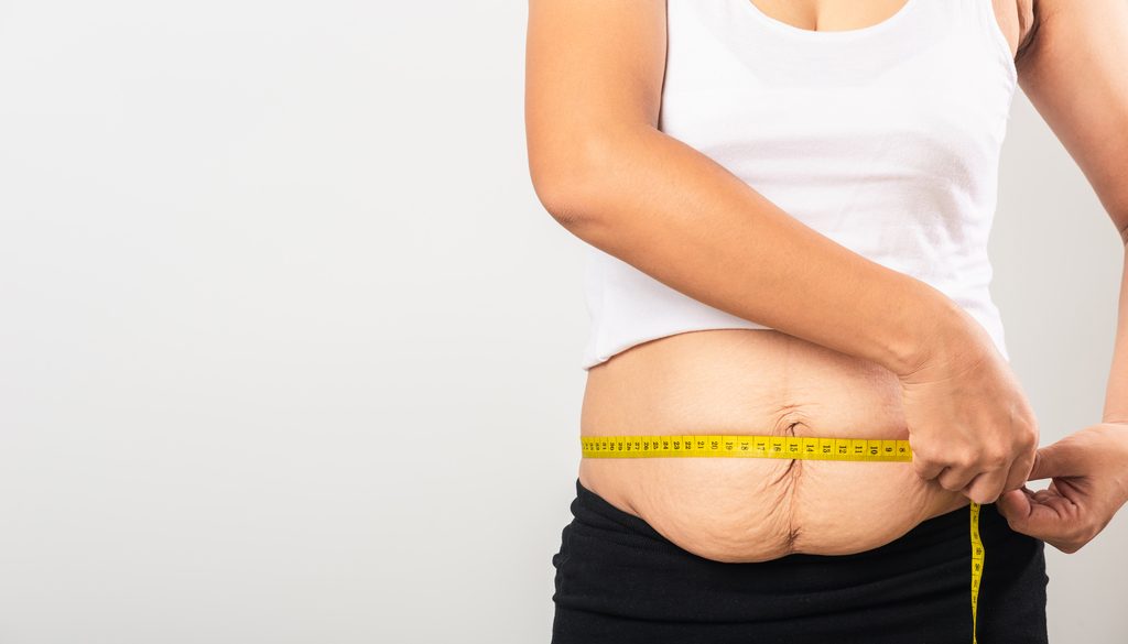 Best Obesity Surgery Options in Istanbul